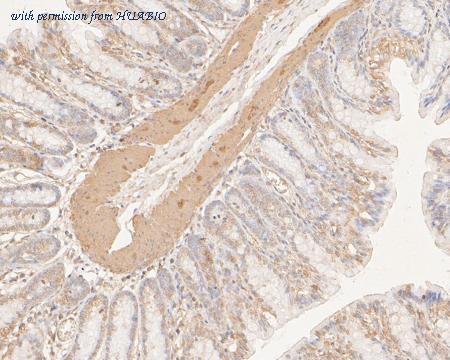 HUABIO ER2001-20 image 1