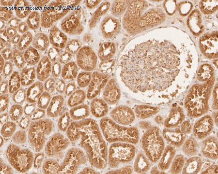 HUABIO ER2001-20 image 3