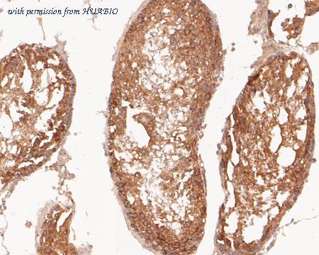 HUABIO ER2001-25 image 3