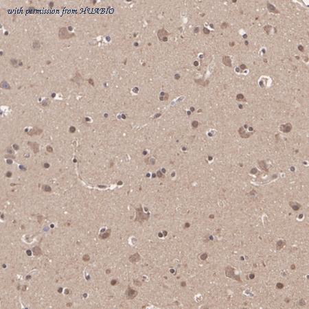 HUABIO ER2001-29 image 2