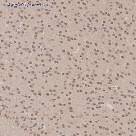 HUABIO ER2001-29 image 3