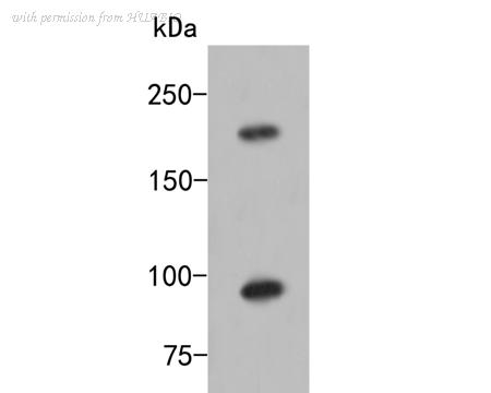 HUABIO ER2001-33 image 1
