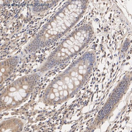 HUABIO ER2001-33 image 2