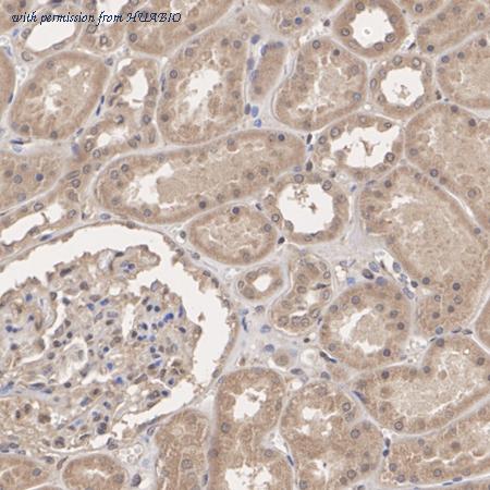 HUABIO ER2001-33 image 3