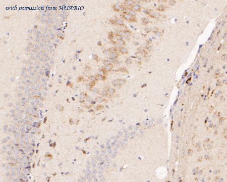 HUABIO ER2001-36 image 2