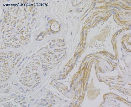 HUABIO ER2001-40 image 2