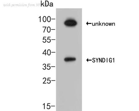 HUABIO ER2001-43 image 1