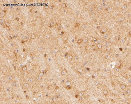 HUABIO ER2001-43 image 2