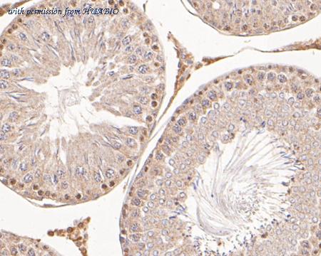 HUABIO ER2001-45 image 2