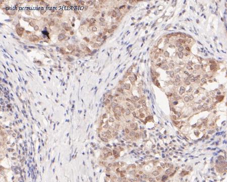 HUABIO ER2001-57 image 2