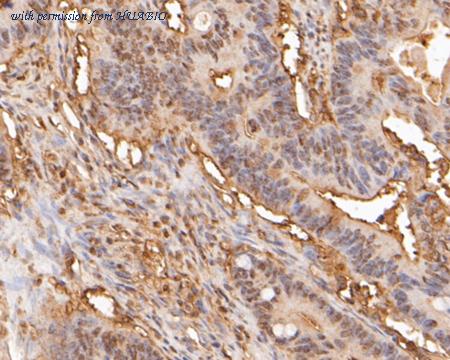 HUABIO ER2001-68 image 3