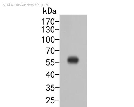 HUABIO ER2001-70 image 1