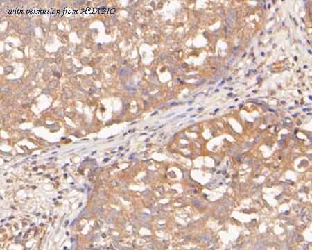 HUABIO ER2001-70 image 3