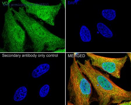 HUABIO ER30603 image 2
