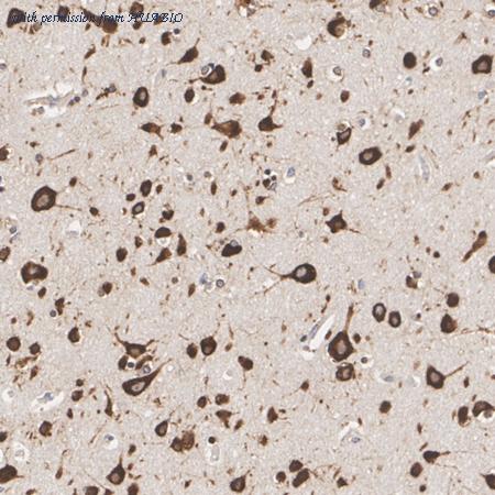 HUABIO ER62454 image 2