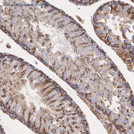 HUABIO ER62454 image 3