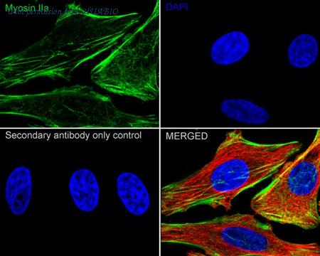 HUABIO ER62480 image 2