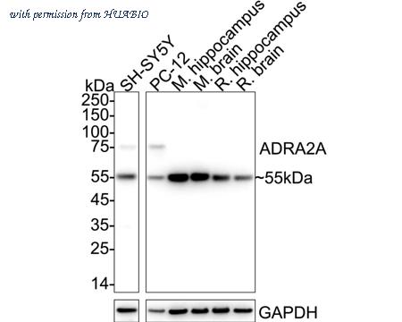 HUABIO ER62703 image 1