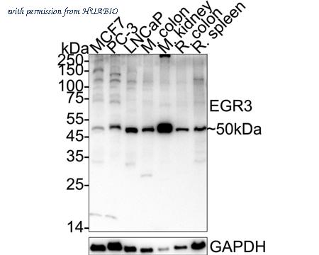 HUABIO ER63324 image 1