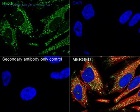 HUABIO ER63676 image 3