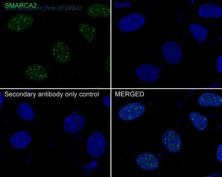 HUABIO ER65406 image 2