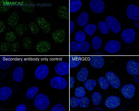 HUABIO ER65406 image 3