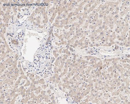 HUABIO ER65664 image 2