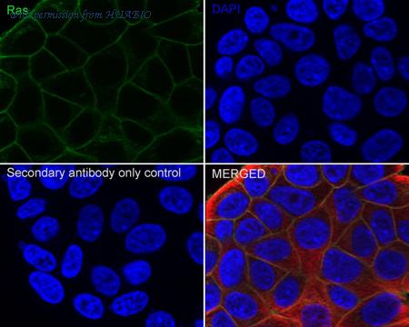 HUABIO ET1601-16 image 2