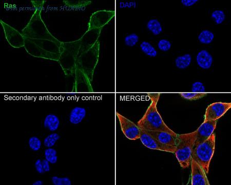 HUABIO ET1601-16 image 3