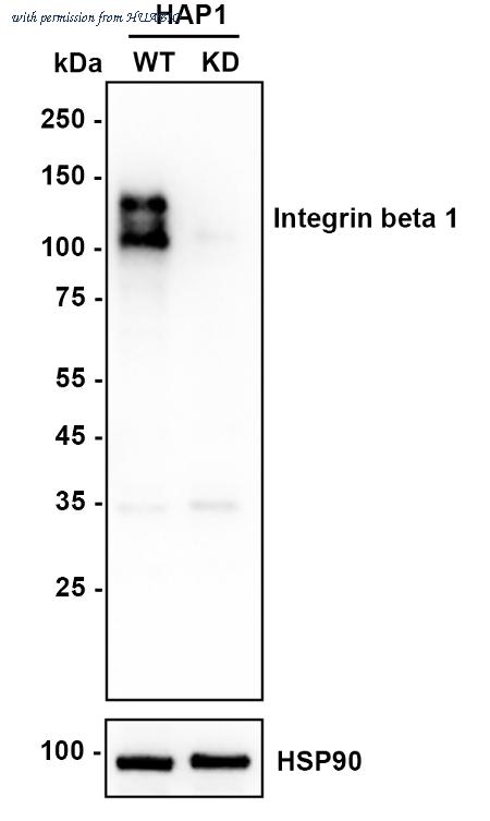 HUABIO ET1601-17 image 2