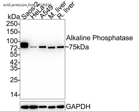 HUABIO ET1601-21-50UL image 1