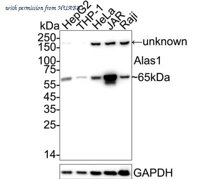 HUABIO ET1601-26 image 2