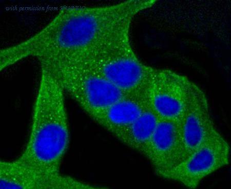 HUABIO ET1601-26 image 3