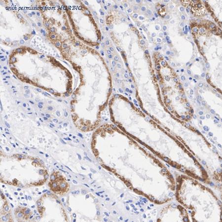 HUABIO ET1601-27 image 2