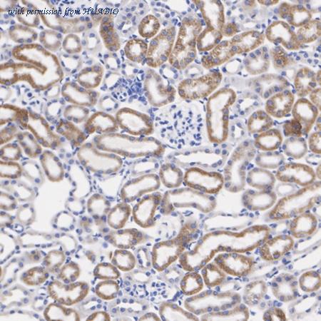 HUABIO ET1601-27 image 3