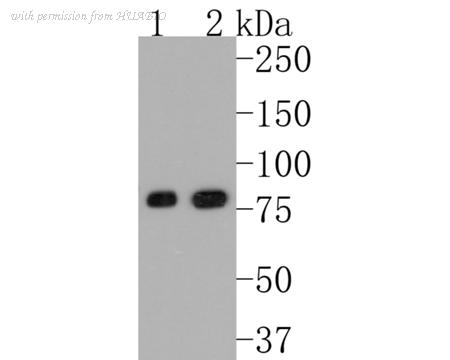 HUABIO ET1602-13 image 1