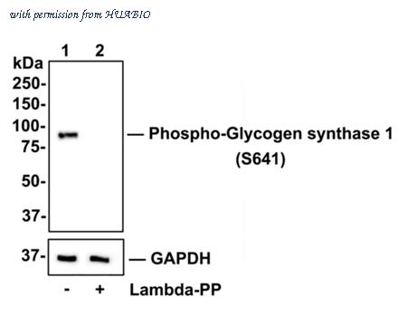 HUABIO ET1602-13 image 2