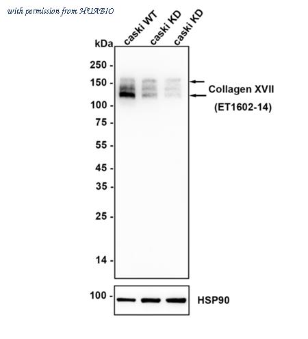 HUABIO ET1602-14-50UL image 2