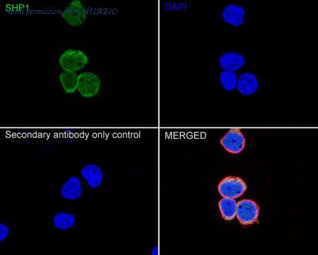 HUABIO ET1602-19-50UL image 2