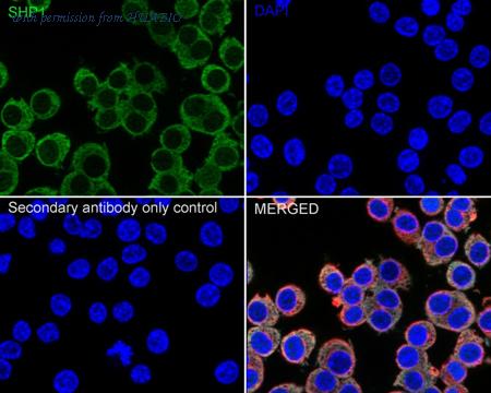HUABIO ET1602-19-50UL image 3