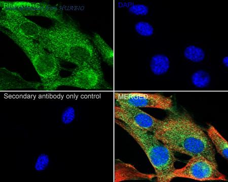 HUABIO ET1602-23 image 3
