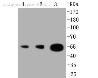 HUABIO ET1602-27 image 1
