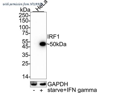 HUABIO ET1602-28 image 1