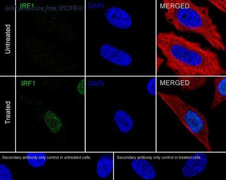 HUABIO ET1602-28 image 3