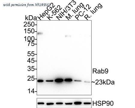 HUABIO ET1602-29 image 1