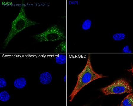 HUABIO ET1602-29 image 3