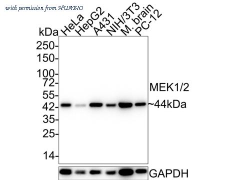 HUABIO ET1602-3 image 1