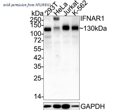 HUABIO ET1602-37-50UL image 1