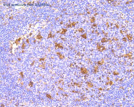 HUABIO ET1602-37-50UL image 2