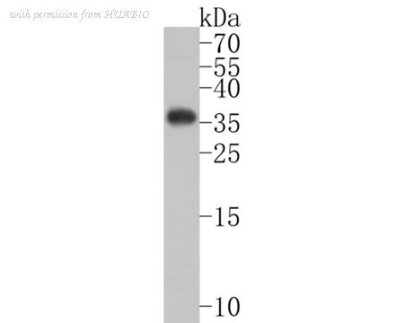 HUABIO ET1602-45 image 1